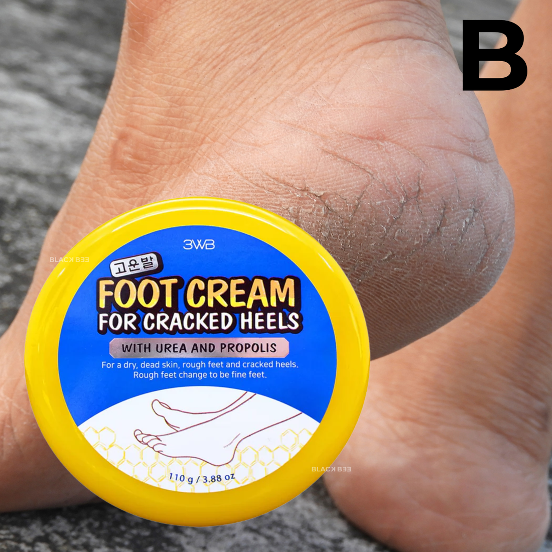 CREMA CON UREA PARA PIES CON GRIETAS